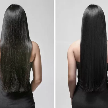 Como Parar a Queda de Cabelo: Dicas Reais