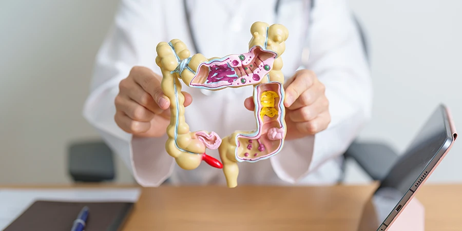 Maneiras fáceis de melhorar sua digestão - AdobeStock Maneiras fáceis de melhorar sua digestão - AdobeStock