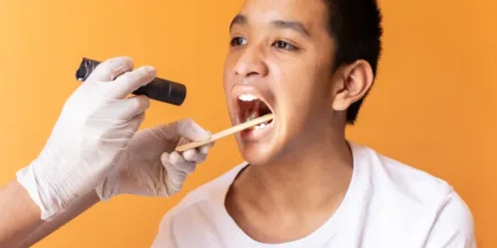 O que é amigdalite e como tratá-la - tonsillitis