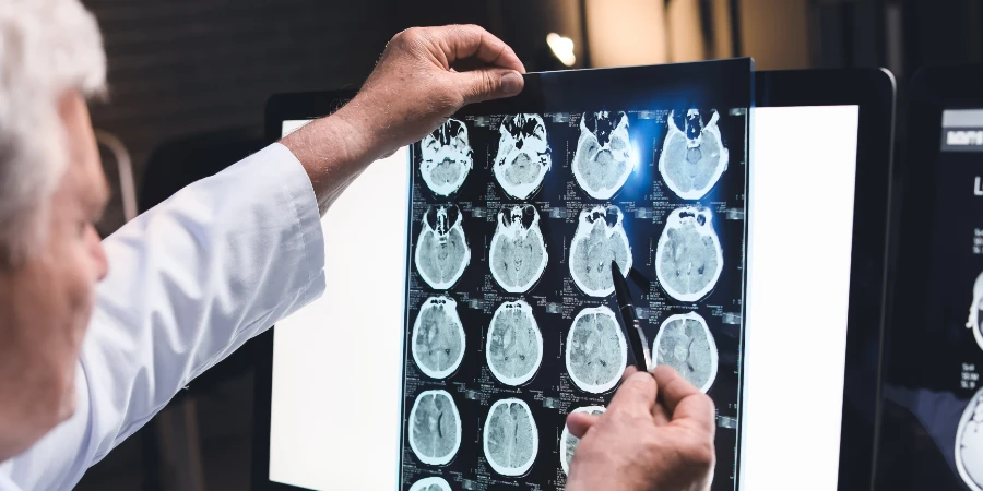 Tipos de Dores de Cabeça e Como Obter um Diagnóstico - trauma headache Tipos de Dores de Cabeça e Como Obter um Diagnóstico - trauma headache