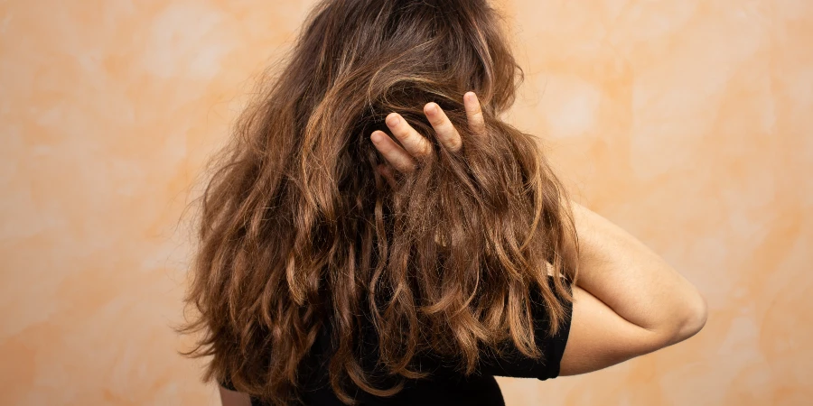 Como cuidar de cabelos secos: as melhores dicas? - causes of dryness Como cuidar de cabelos secos: as melhores dicas? - causes of dryness