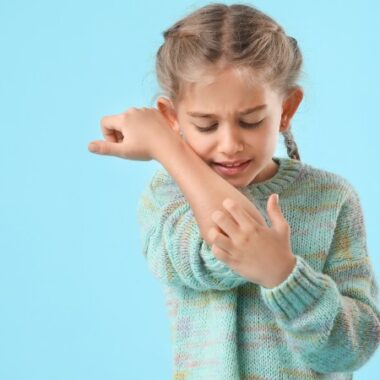 O que Você Precisa Saber Sobre Picadas de Pulgas