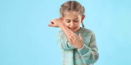 O que Você Precisa Saber Sobre Picadas de Pulgas - flea bites