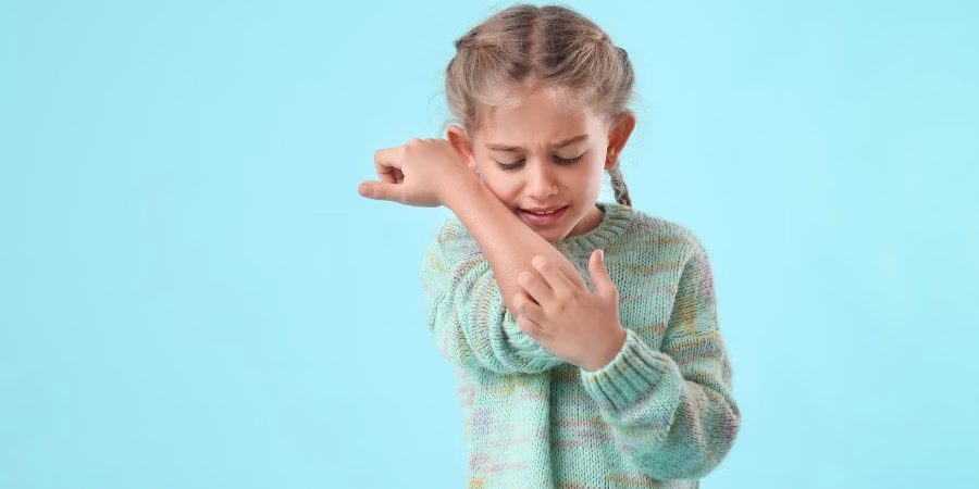 O que Você Precisa Saber Sobre Picadas de Pulgas - flea bites