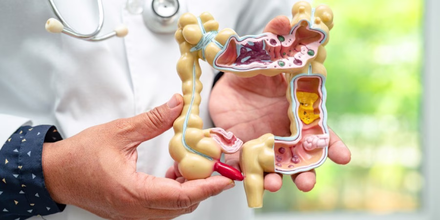 8 Benefícios do Vinagre de Maçã para a Saúde Comprovados Cientificamente - acv gut health 8 Benefícios do Vinagre de Maçã para a Saúde Comprovados Cientificamente - acv gut health