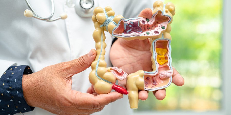 8 Benefícios do Vinagre de Maçã para a Saúde Comprovados Cientificamente - acv gut health 8 Benefícios do Vinagre de Maçã para a Saúde Comprovados Cientificamente - acv gut health