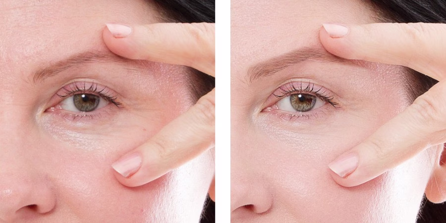 Os Benefícios Mais Importantes dos Suplementos de Colágeno - collagen skin