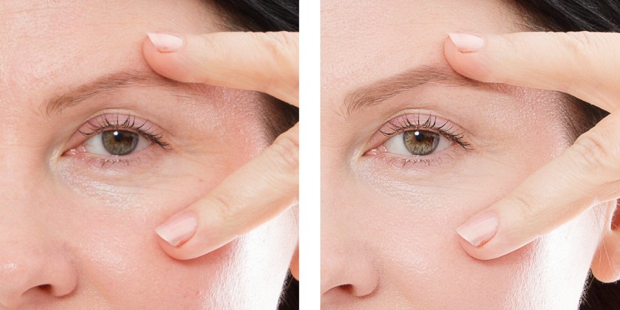 Os Benefícios Mais Importantes dos Suplementos de Colágeno - collagen skin Os Benefícios Mais Importantes dos Suplementos de Colágeno - collagen skin